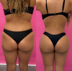 Before & After